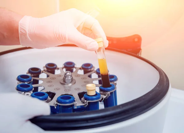 Trombosit zengini plazma hazırlığı. Elleri kanlı tüp. Santrifüj.