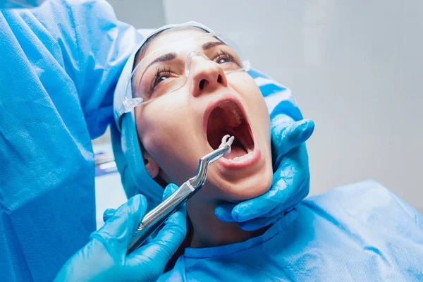 Dentista Con Pinze Chirurgiche Rimuovere Dente Cariato Moderna Clinica Dentale — Foto Stock