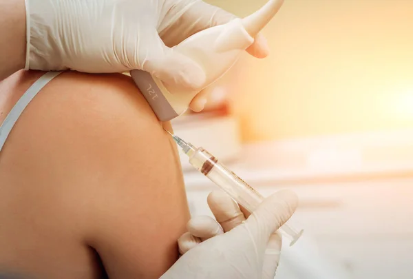 Omzunun ultrason güdümlü trombosit zengini plazma enjeksiyonu.