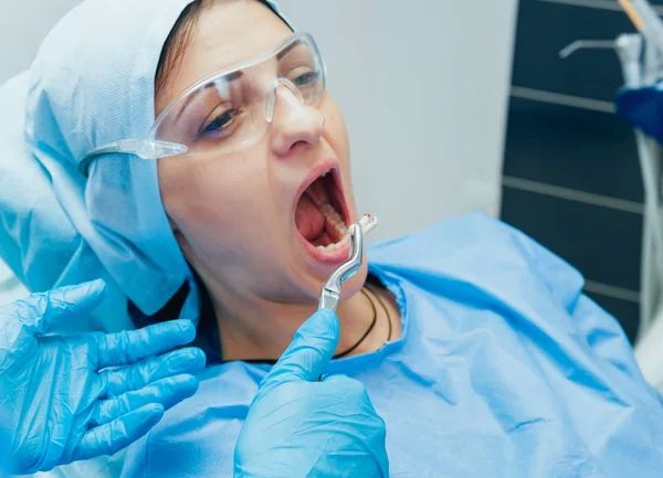 Dentista Usando Alicate Cirúrgico Para Remover Dente Decomposição Clínica Odontológica — Fotografia de Stock