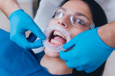 Expander, fotoğraf protokolü için hazırlık montajı. 