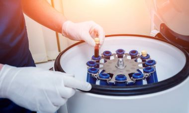 Trombosit zengini plazma hazırlığı. Elleri kanlı tüp. Santrifüj.