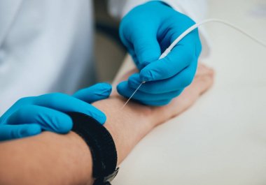 Hasta sinirleri elektromiyografi ile test ediliyor. Tıbbi muayene. EMG