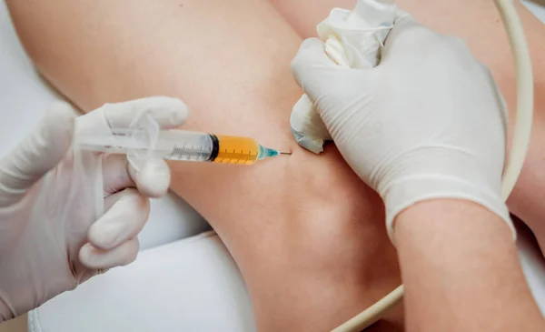 Ultrasone Geleide Bloedplaatjesrijke Plasma Injectie Van Knie — Stockfoto