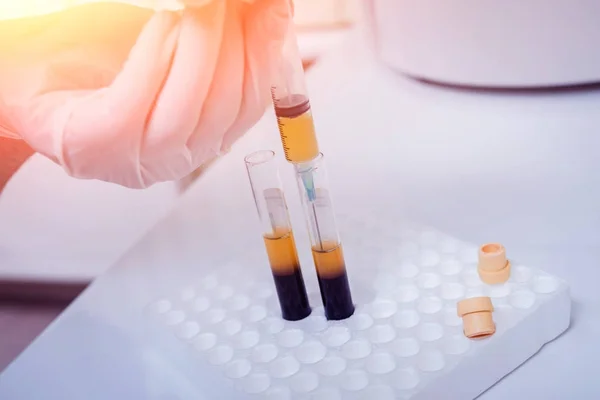 Platelet-Rich plasma preparation. Plasma in syringe. Centrifuge.