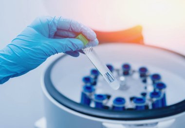 Tıbbi Laboratuar santrifüj tüpleri ile