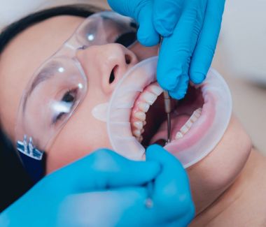 Expander ile diş tedavisi. 