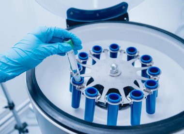 Tıbbi Laboratuar santrifüj tüpleri ile