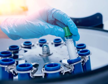 Tıbbi Laboratuar santrifüj tüpleri ile