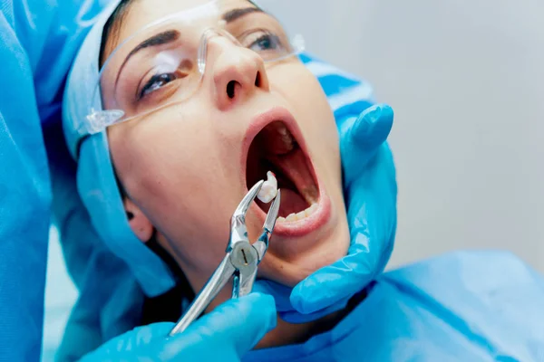 Dentist Using Surgical Pliers Remove Decaying Tooth Modern Dental Clinic — Stock Photo, Image