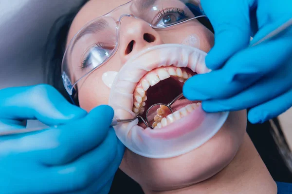Tandvård Med Expander — Stockfoto