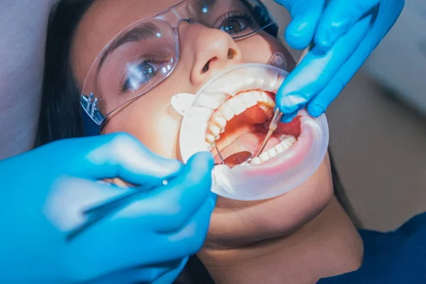 Trattamento Dentale Con Espansore — Foto Stock
