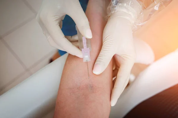 Nahaufnahme Der Hände Einer Krankenschwester Bei Der Entnahme Einer Blutprobe — Stockfoto