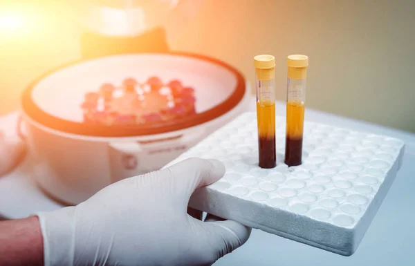 Trombosit zengini plazma hazırlığı. Elleri kanlı tüp. Santrifüj.