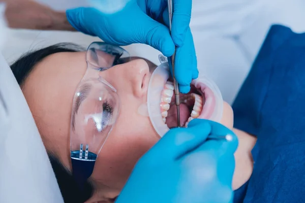 Trattamento Dentale Con Espansore — Foto Stock