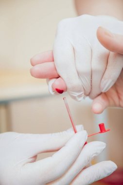 Bir kan örneği alarak hemşire. Tıbbi malzeme. Kan testi
