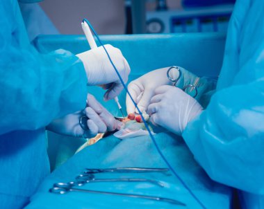 Göğüs cerrahi ameliyathane. 