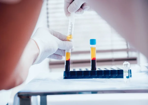 Trombosit zengini plazma hazırlığı. Şırıngada plazma. Santrifüj.