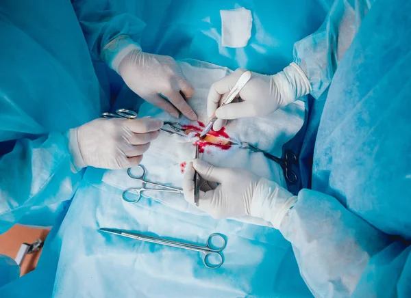 Gruppo Chirurghi Sala Operatoria Con Attrezzature Chirurgiche — Foto Stock