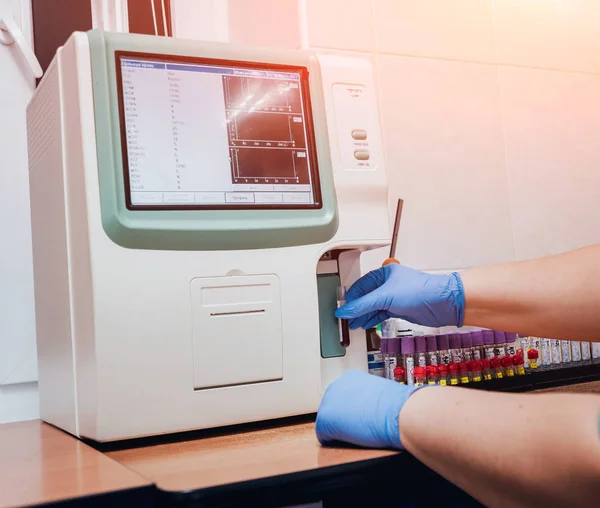 Laborassistentin Führt Bluttest Durch Medizinische Geräte — Stockfoto
