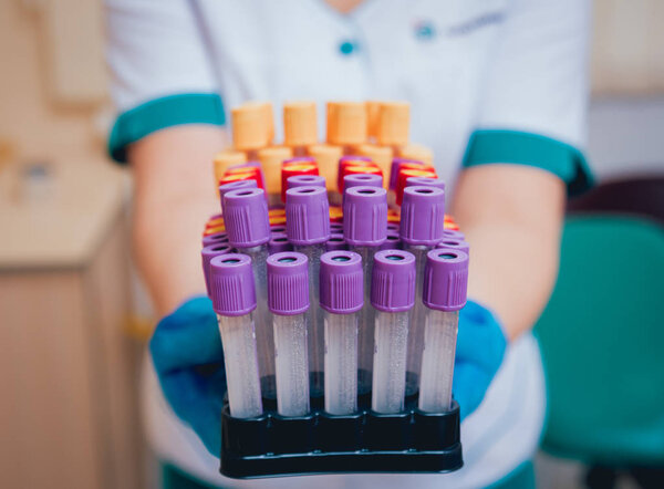 Empty tubes. Medical equipment. Blood test