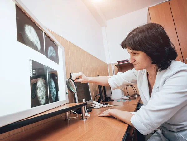 Arzt Untersucht Mammografie Test Medizinische Geräte Krankenhaus — Stockfoto