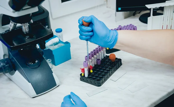 Assistente Laboratorio Effettua Esame Del Sangue Attrezzature Mediche — Foto Stock