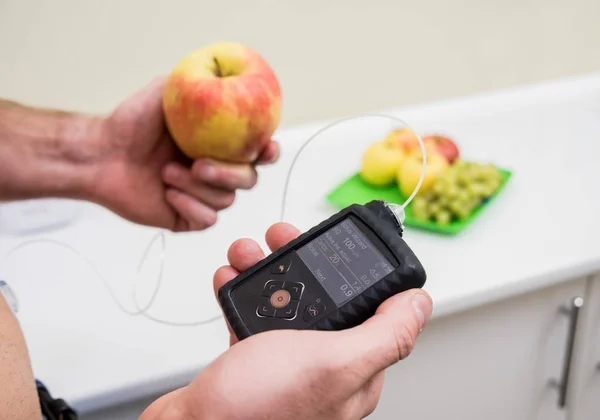 Diabetiker mit einer im Bauch verbundenen Insulinpumpe. Die Insulinpumpe berechnet die Insulindosis. Diabetes-Konzept. — Stockfoto