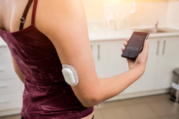 Medical device for glucose check. Continuous glucose monitoring pod. — Stock Photo, Image