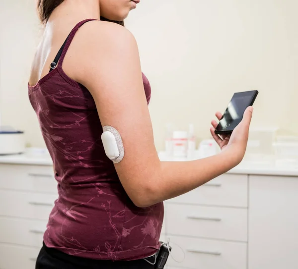 Dispositivo médico para verificação de glicose. Vagem de monitorização contínua da glucose . — Fotografia de Stock