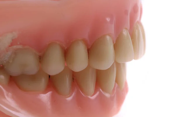 Фон протеза зубов — стоковое фото