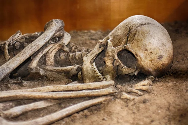 Stare ludzkie kości — Zdjęcie stockowe