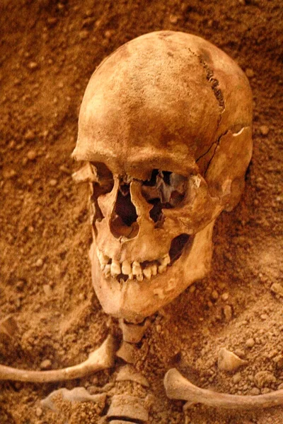 Cráneo humano viejo —  Fotos de Stock