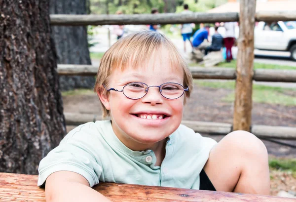 Niño pequeño con síndrome de Down sentado en la mesa — Foto de Stock