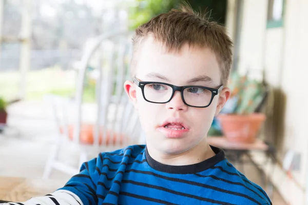 Menino com síndrome de Downs — Fotografia de Stock