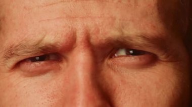 Genç bir beyaz erkek yakın çekim çekim gözleri. winks ve gülüyor, görünür kırışıklıkları