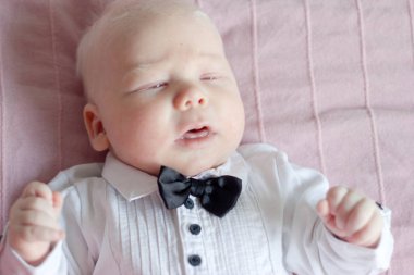 Whitehair babyboy albinizm Sendromu