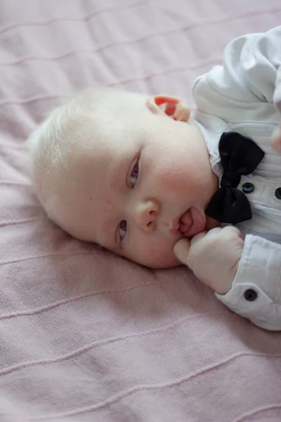 Whitehair babyboy com síndrome do albinismo — Fotografia de Stock