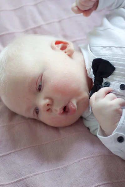 Babyboy pelo blanco con síndrome de albinismo —  Fotos de Stock