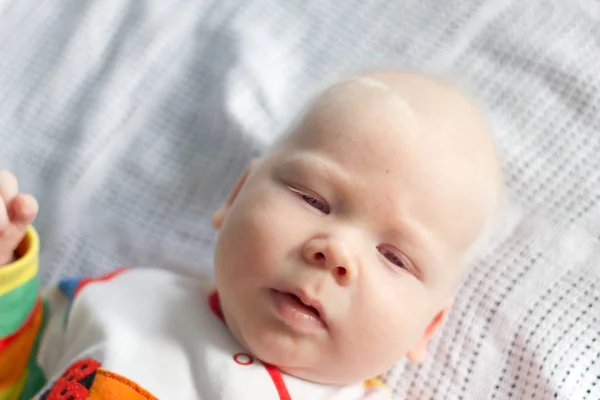 Мальчик с белыми волосами и синдромом альбинизма — стоковое фото