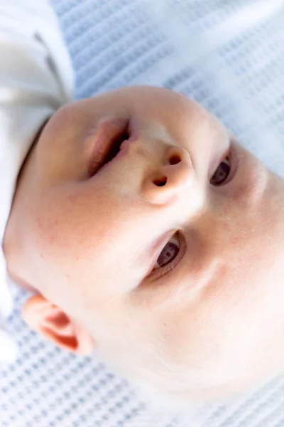 Pelo bianco neonato con sindrome di albinismo — Foto Stock