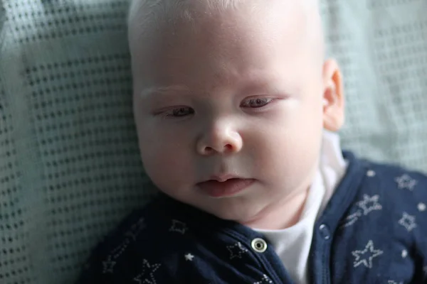 Whitehair babyboy com síndrome do albinismo — Fotografia de Stock