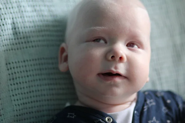 Babyboy aux cheveux blancs avec syndrome d'albinisme — Photo