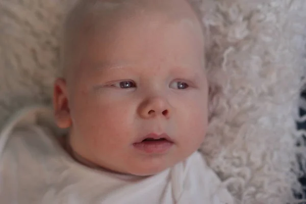 Babyboy pelo blanco con síndrome de albinismo —  Fotos de Stock