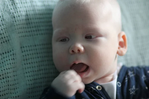 Whitehair babyboy s albinismem syndrom — Stock fotografie