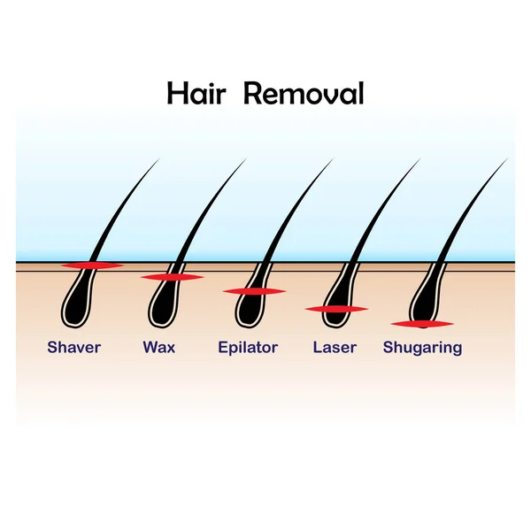 Color de depilación — Vector de stock
