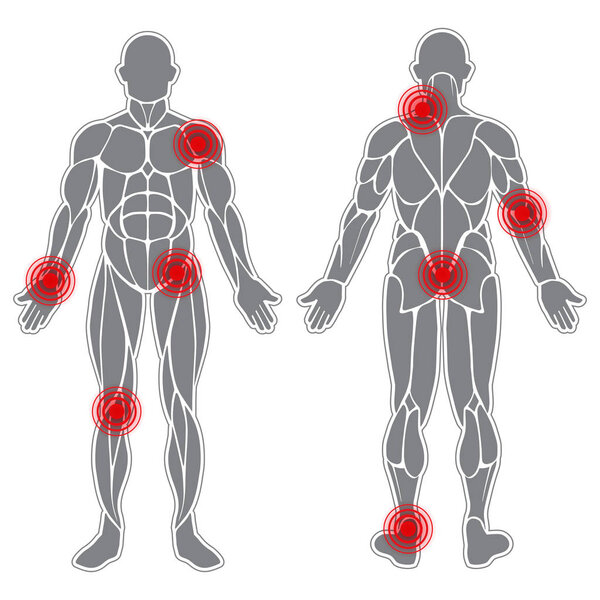 Слабые суставы человека
