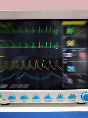 Hastanede yatağın yan tarafında kalp rahatsızlığı monitörü var.