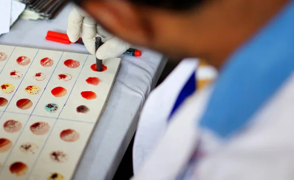 Labortechnikus Adjunk Reagenst Vérmintához Hogy Megtudjuk Vércsoport Minta Kórházban — Stock Fotó