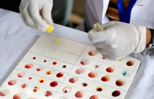 Laboratuvar teknisyeni kan örneğine reaktör ekleyerek bir hastanede kan grubunu tespit etti.